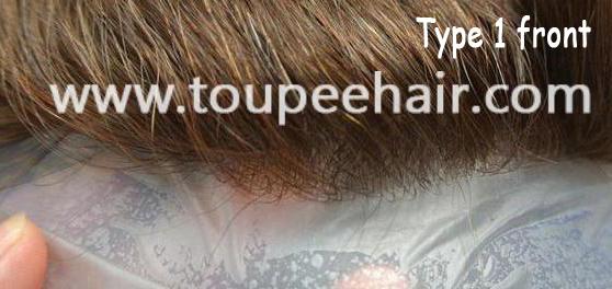 Type 1 v-looped invisible front hairline Type 1 v-looped invisible front hairline